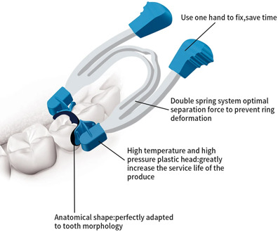 Dental Sectional Contoured Metal Spring Clip Teeth Replacement Dentist Matrix Ring Tools Lab Instrument