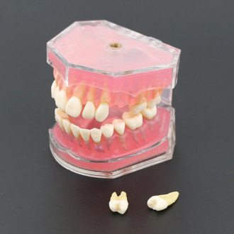 Dental Standard Model with Removable Teeth #4004 01 Dental Study Teach Teeth Model