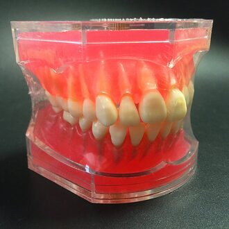 Dental Studie Onderwijs Model Standaard Model Removable Tanden Zachte Gum Adult Typodont Model