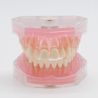 Dental Tanden Model Studie Onderwijs Standaard Model Removable Soft Gum Tanden Typodont Kunstgebit Model Tandheelkundige