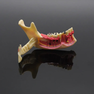 Dentistry Teaching Training Model Dental Communication Model Mandibular Model