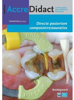 Directe Posteriore Composietrestauraties - Accredidact - Bas Loomans