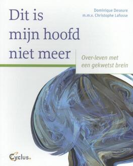Dit is mijn hoofd niet meer - Boek Dominique Deseure (9085750466)