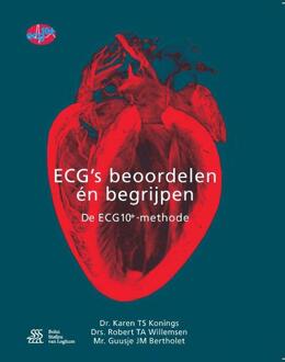 ECG's - beoordelen én begrijpen - Boek Karen Konings (9036817285)