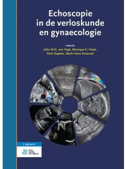 Echoscopie in de verloskunde en gynaecologie - Boek Springer Media B.V. (9036814502)
