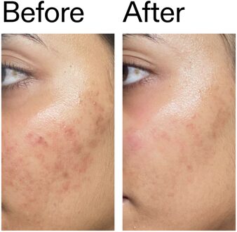 Ectoin Hydro-Barrier Serum 30ml