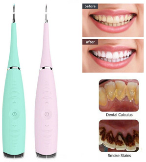 Electric Sonic Dental Scaler Tooth Calculus Remover Cleaner Tooth Stains Tartar Tool Dentist Whiten Teeth Health Oral Cleaner