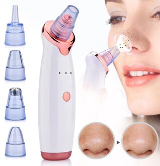 Elektrische Vacuüm Zuig Remover Cleaner Tool Gezicht Reiniging Mee-eter Verwijderen Zwart Spot Facial Skin Scrubber T Zone Porie Schoner wit