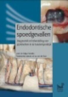 Endodontische spoedgevallen - Boek Edgar Schäfer (9085620635)
