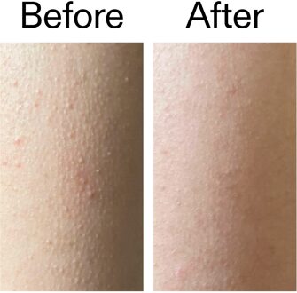 Exfoliërende Bodystick met Glycolzuur 45g