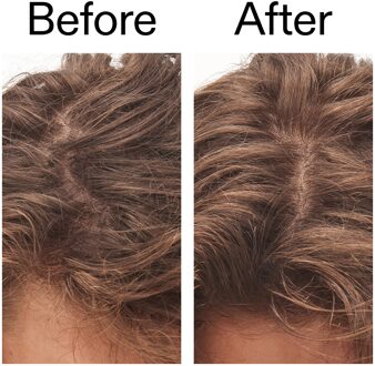 Exfoliërende Hoofdhuidscrub met Glycolzuur 150 ml