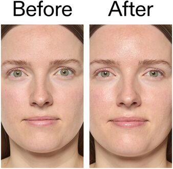 Exosome Hydro-Glow Complex 30ml