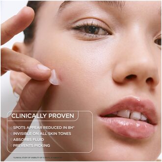 Garnier Pure Active 8hr Invisible Hydrocolloid Blemish Patch Cruelty Free & Vegan - 44 patches