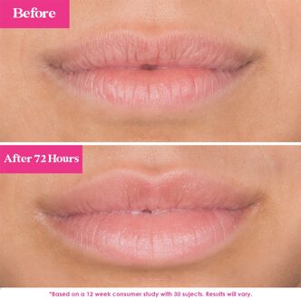 GrandePOUT Verstevigend Lipmasker - Berry Mojito