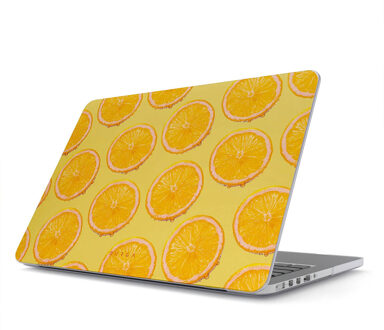 Hardshell Cover voor de Apple MacBook Pro 16 inch (2021 / 2023 M3 chip / 2024 M4 chip) - Bitter Meerkleurig