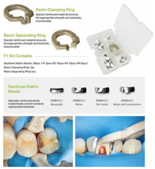 High Quanlity Dental Sectional Matrix System Dental Sectional Matrix Band Resin Clamping/Seperating Ring Dentist Tools