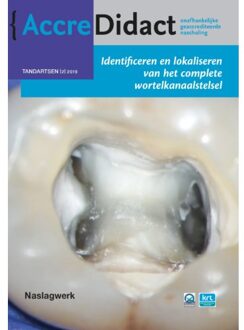 Identificeren En Lokaliseren Van Het Complete