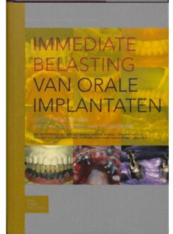 Immediate belasting van orale implantaten - Boek Springer Media B.V. (9031351741)