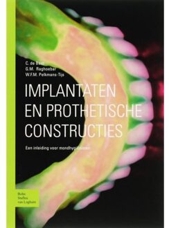 Implantaten en prothetische constructies - Boek C. de Baat (9031343811)