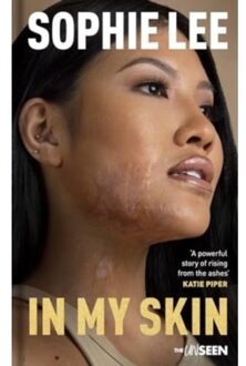 In My Skin - Katie Piper's The Unseen - Lee, Sophie
