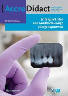Interpretatie Van Tandheelkundige Röntgenopnamen - Accredidact - Paul van der Stelt
