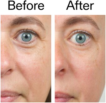 Intro Routine for Anti-ageing