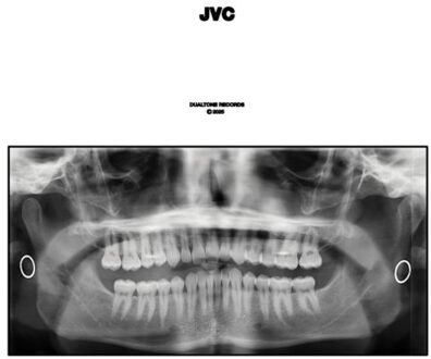 Jvc - Jack Van Cleaf