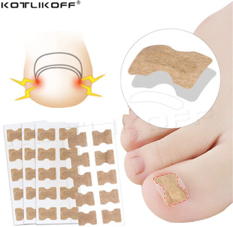 KOTLIKOFF 10PCS Ingrown Toenail Corrector Stickers Paronychia Treatment Recover Corrector Pedicure Tool Fingernail Toe Nail Care