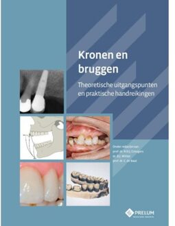 Kronen en bruggen - Boek N.H.J. Creugers (9085621348)