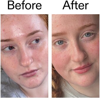 Lichtgewicht moisturizer met vitamine B C en E, 50ml