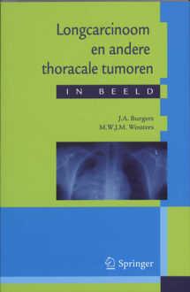Longcarcinoom en andere thoracale tumoren / in beeld - Boek J.A. Burgers (9031362611)