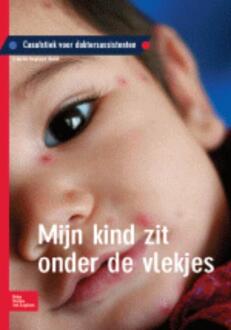 Mijn kind zit onder de vlekjes - Boek S. van der Krogt (9031378984)