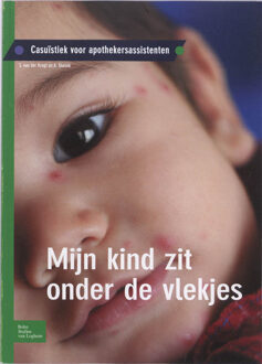 Mijn kind zit onder de vlekjes - Boek S. van der Krogt (903137900X)