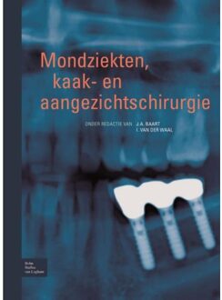 Mondziekten, kaak- en aangezichtschirurgie - Boek Springer Media B.V. (9031353213)