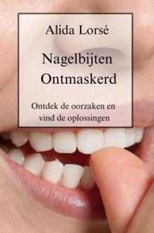 Nagelbijten Ontmaskerd -  Alida Lorsé (ISBN: 9789403751610)