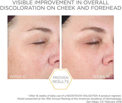 Neostrata Enlighten Crème voor Pigmentcontrole met Retinol en Vitamine C 50 ml