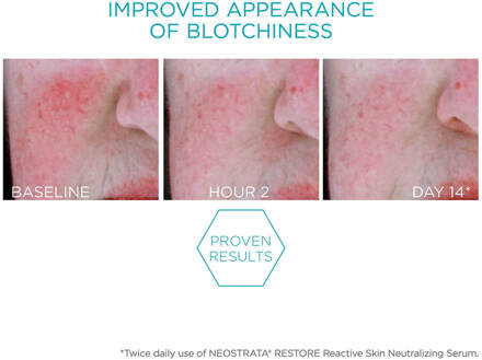 Neostrata Restore Redness Neutralising Serum for Sensitive Skin 29g