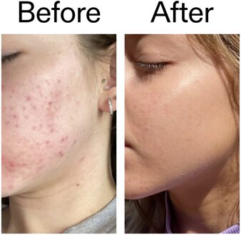 Niacinamide Serum 30 ml