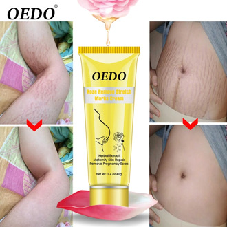 OEDO Rose Remove Stretch Marks Cream Anti Aging Maternity Skin Repair Remove Pregnancy Scars Treatment Body Skin Care