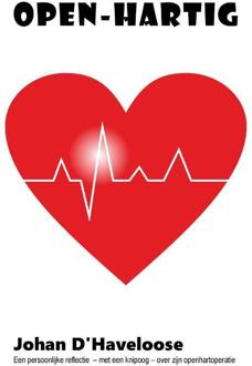 Open-Hartig -  Johan d' Haveloose (ISBN: 9789083534763)