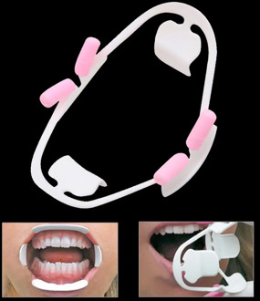 Oral Dental Mouth Opener Intraoral Cheek Lip Retractor Prop Orthodontic Adult