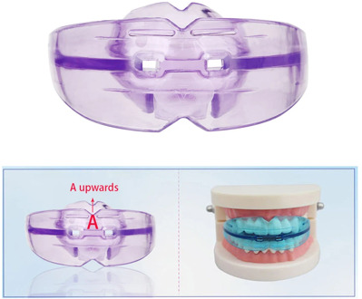 Orthodontic Braces Appliance Dental Braces For Teeth Silicone Alignment Trainer Teeth Straightener Bruxism Mouth Duard Opener
