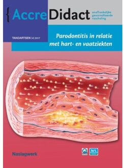 Parodontitis in relatie met hart- en vaatziekten - Boek Bruno Loos (9089762698)