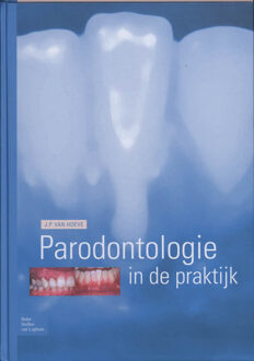 Parodontologie in de Praktijk - Boek J.P. van Hoeve (903135175X)