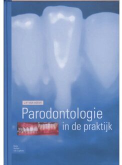 Parodontologie in de Praktijk - Boek J.P. van Hoeve (903135175X)