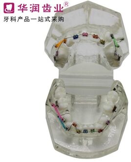 Patiënt Communicatie Model Tandheelkunde Tanden Orthodontische Model