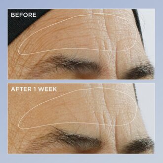 Perricone MD High Potency Retinol Renewal Serum 2oz FG