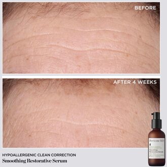 Perricone MD Hypo Clean Correction Smoothing Restorative Serum 2oz FG