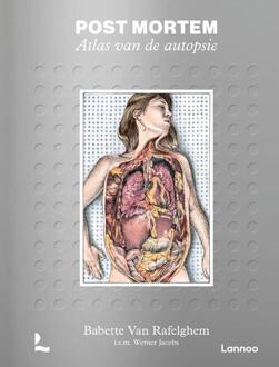 Post mortem. Atlas van de autopsie -  Babette van Rafelghem, Werner Jacobs (ISBN: 9789401491778)
