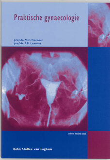 Praktische gynaecologie - Boek M.E. Vierhout (903134124X)